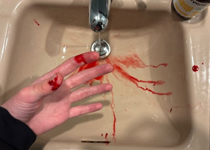 bleeding into the sink
